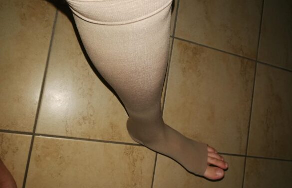 20-30 mmHg Women Knee High Open Toe Compression Socks photo review