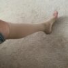20-30 mmHg Men Knee High Open Toe Compression Socks